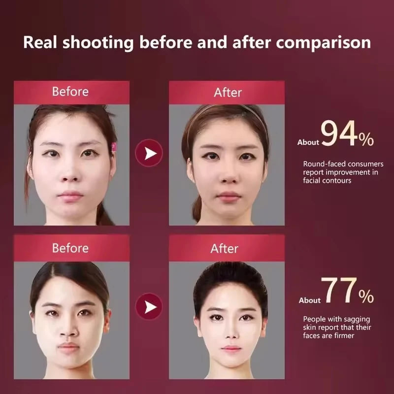 LED Facial Therapy